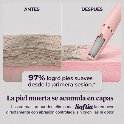 EXFOLIADOR DE CALLOS SOFTIA 2x1 + KIT EXFOLIANTE PARA PIES DE REGALO